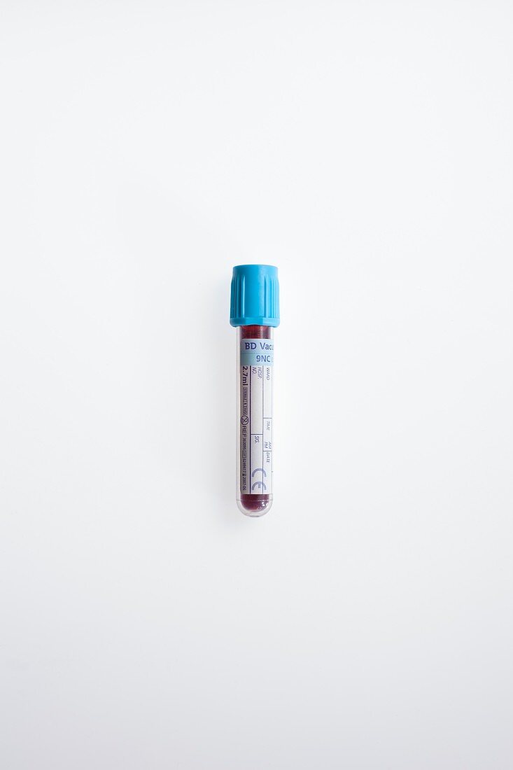 Blood test sample