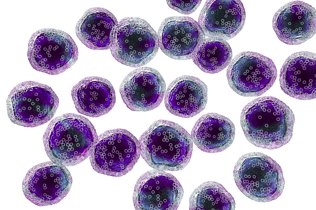 Burkitt's lymphoma cells, illustration