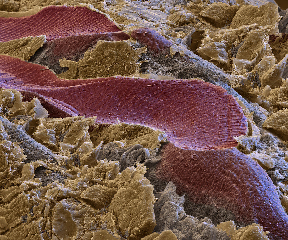 Striated muscle tissue, SEM