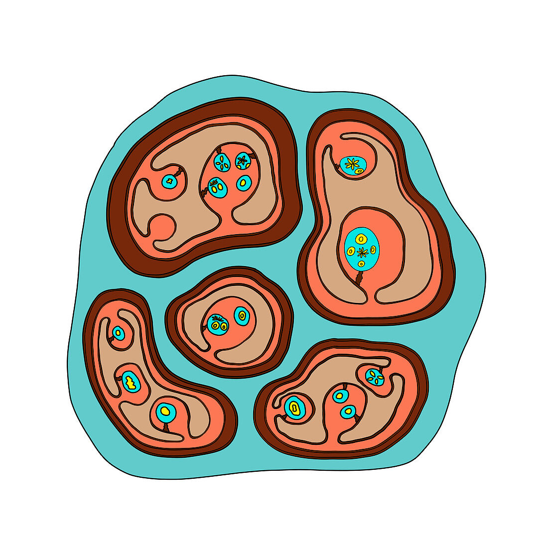Echinococcus multilocularis hydatid cyst, illustration