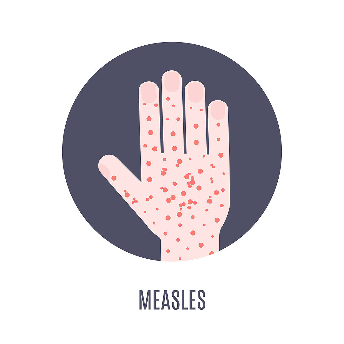 Measles awareness, illustration