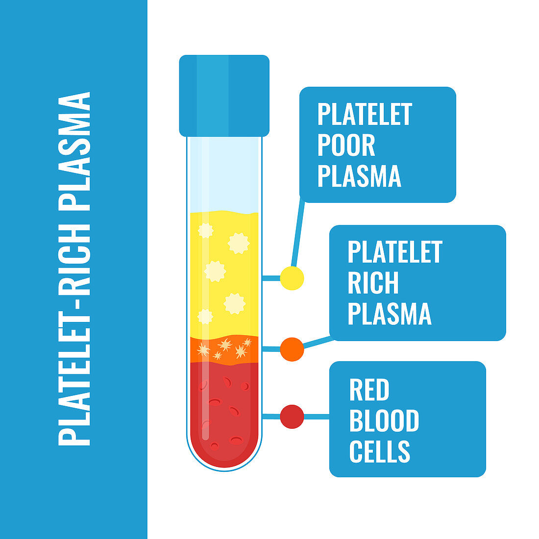 Platelet-rich plasma composition, illustration