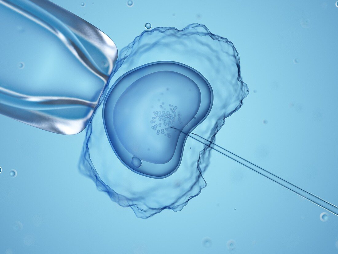 In vitro fertilisation, illustration