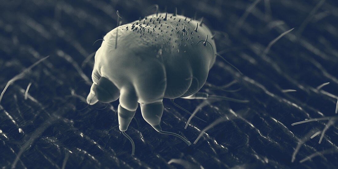 Scabies mite on human skin, illustration