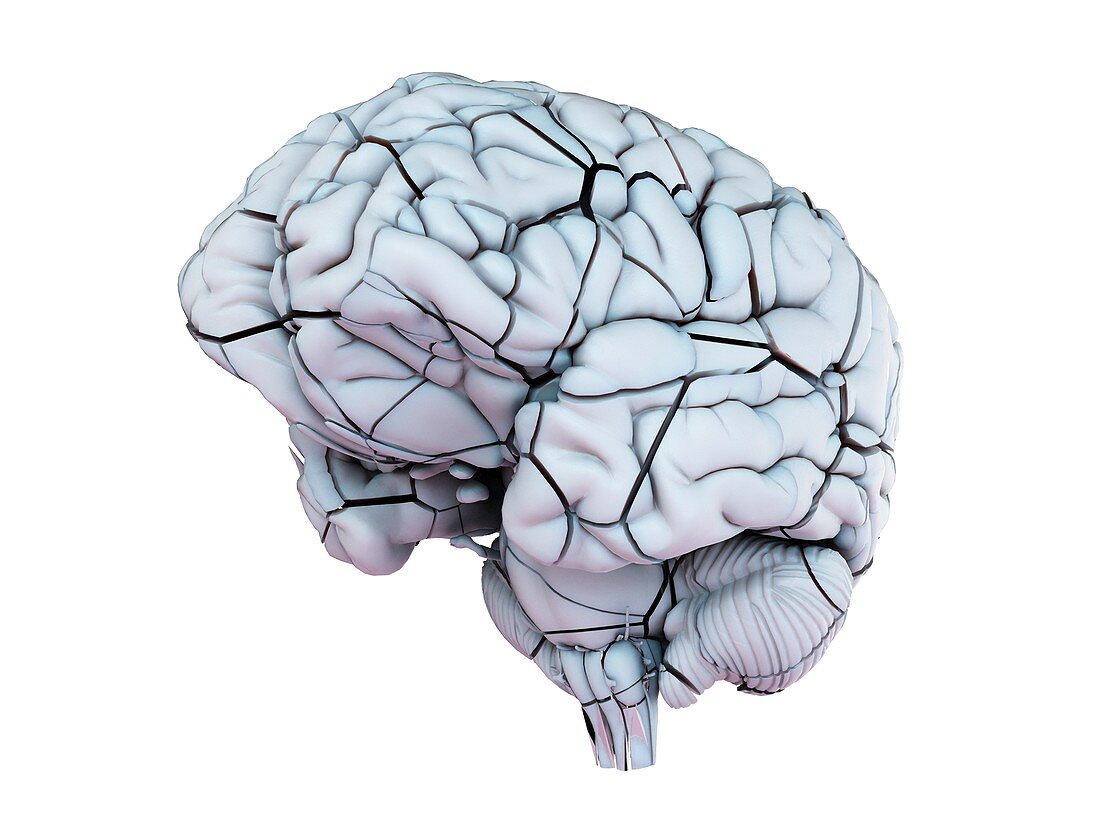 Broken human brain, illustration