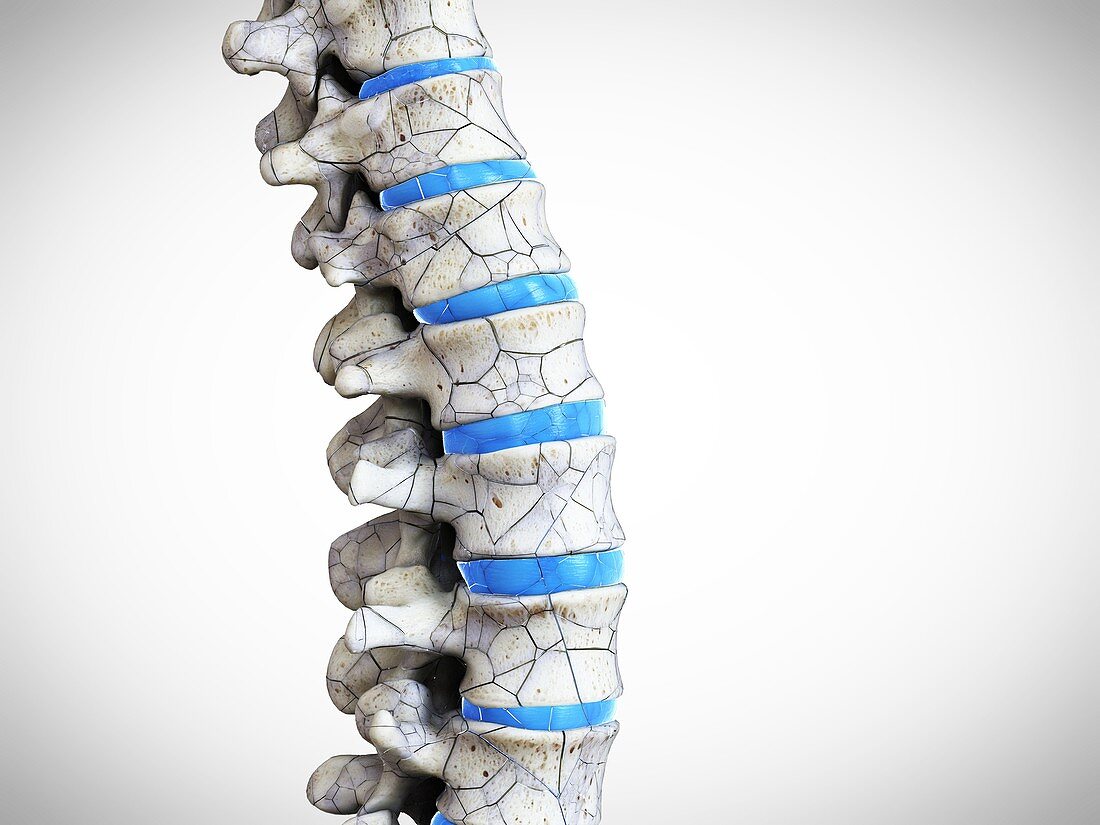 Broken spine, illustration