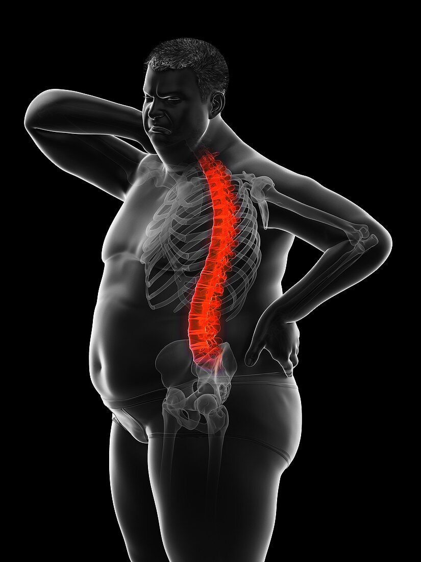 Obese man's painful back, illustration