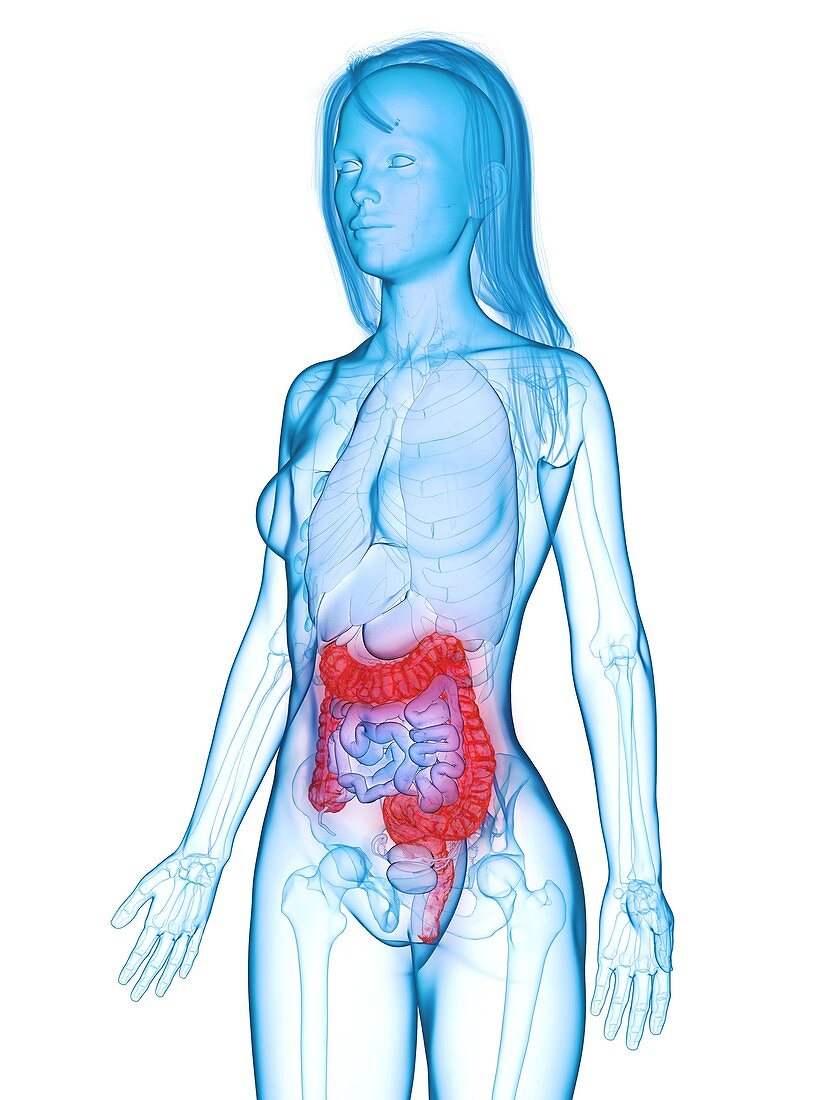 Diseased colon, illustration
