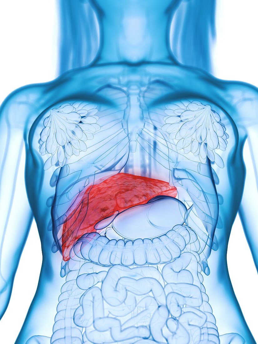 Diseased liver, illustration