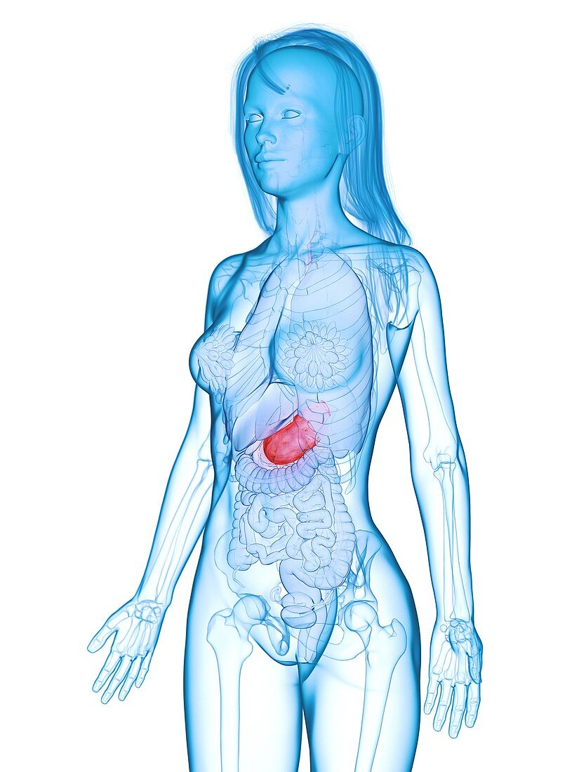 Diseased stomach, illustration