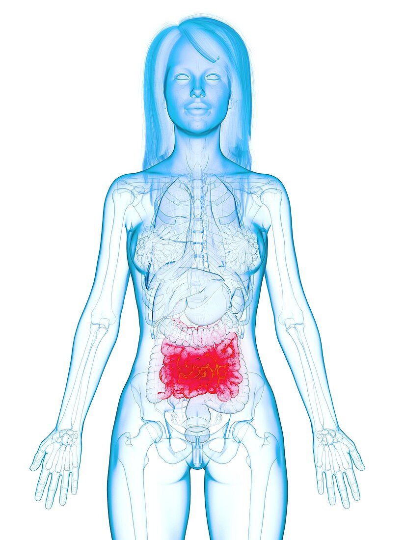 Diseased small intestine, illustration