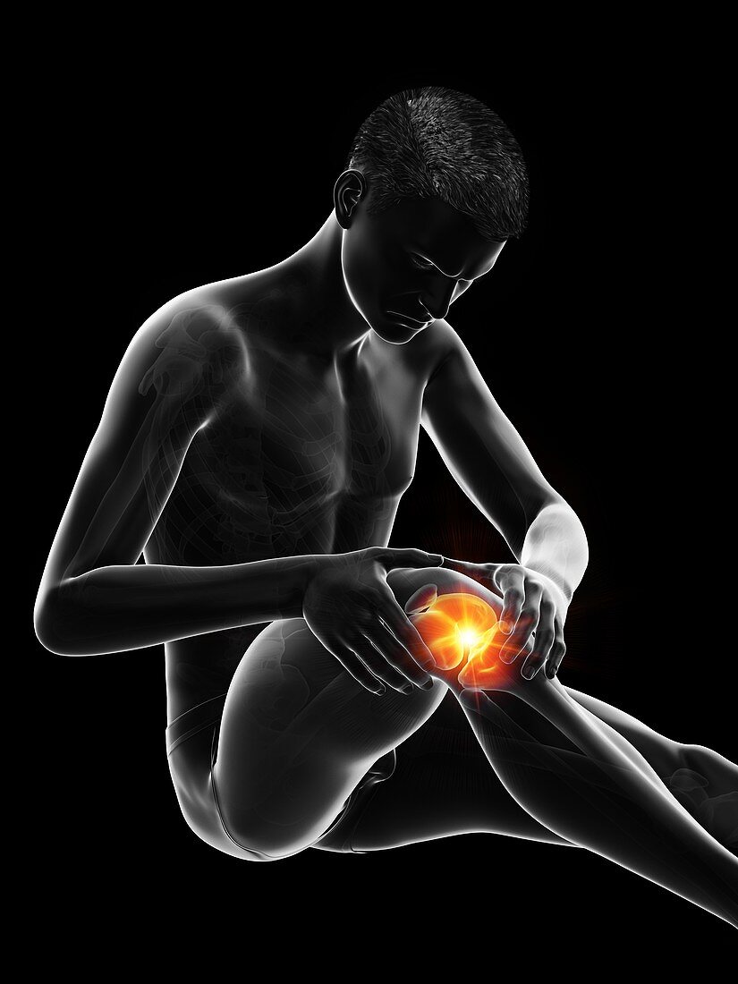 Painful knee, illustration