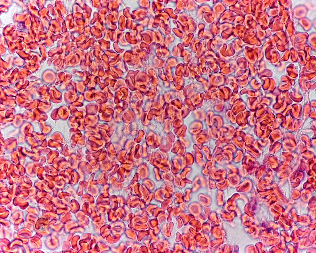 Red blood cells, light micrograph