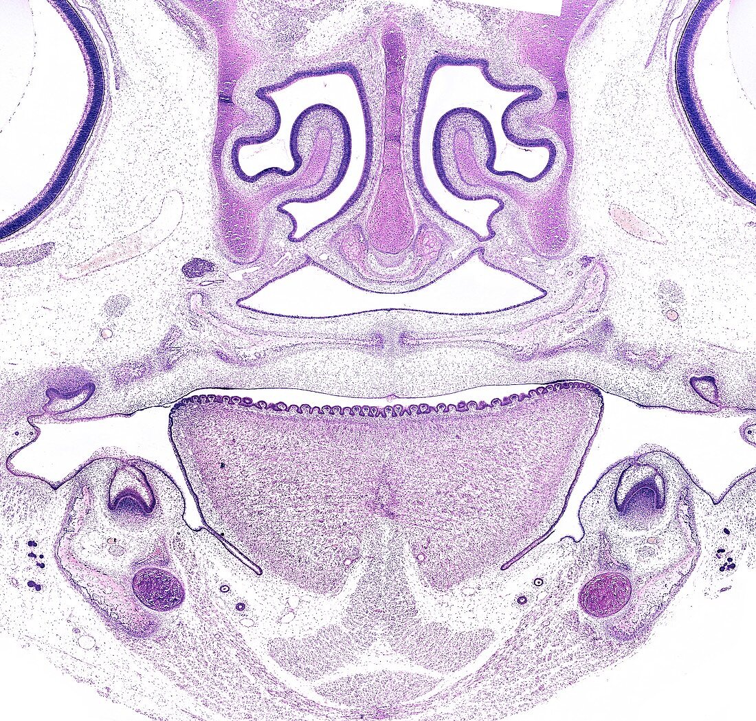 Embryo head, light micrograph