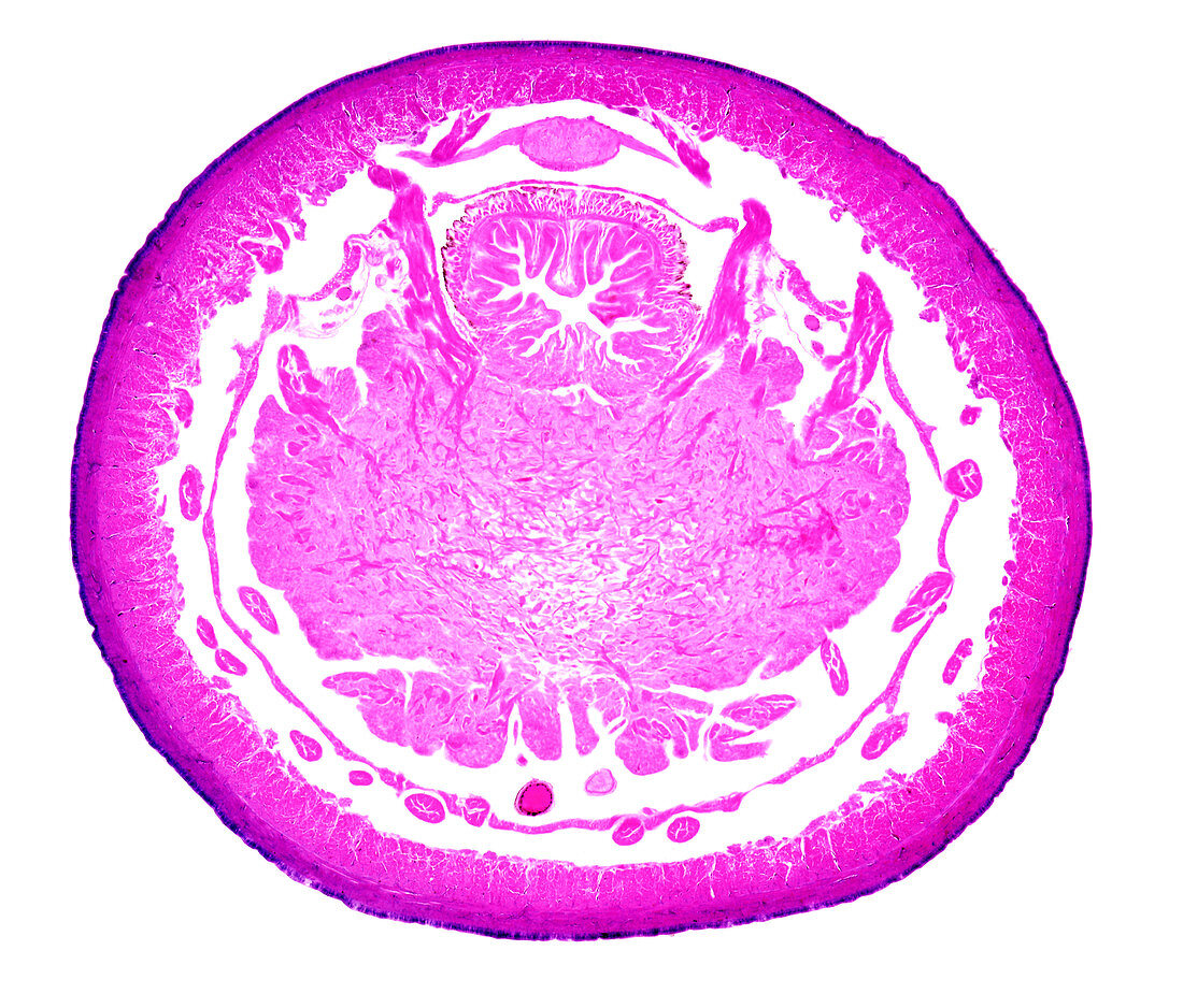 Earthworm pharynx, light micrograph