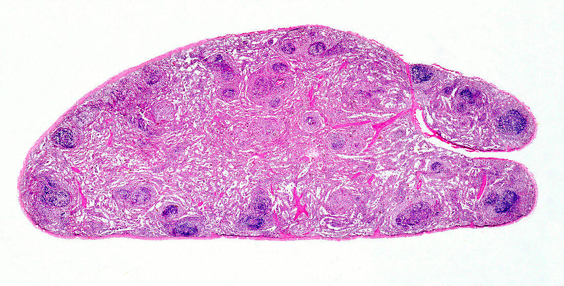 Human spleen, light micrograph