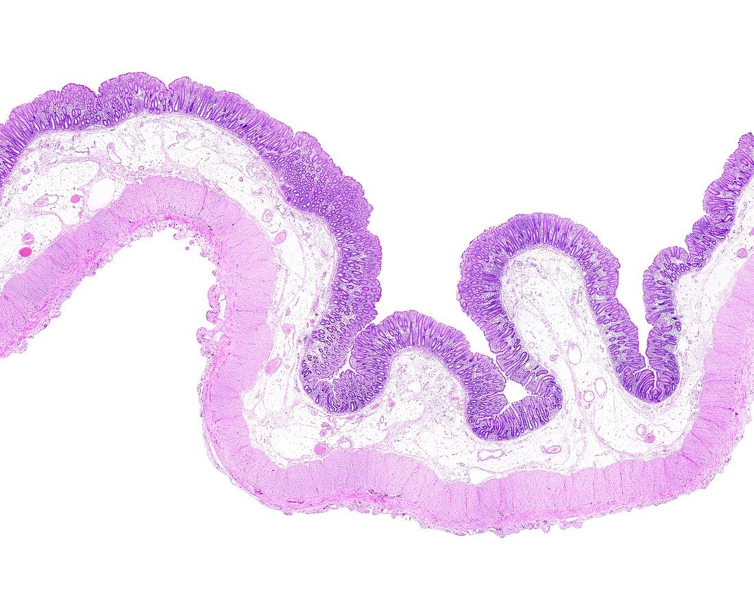 Large intestine, light micrograph