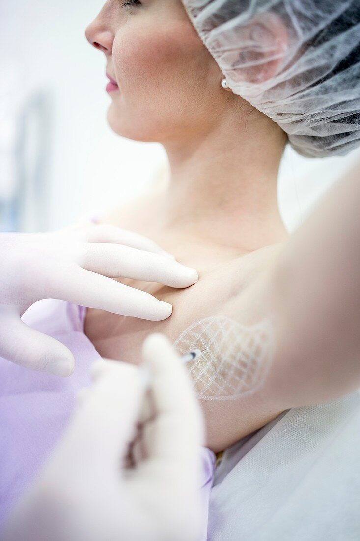 Botox injection in underarm