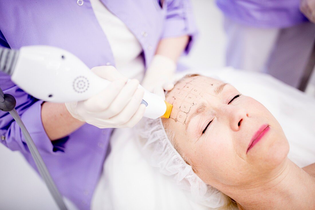 Dermatologist giving thermage treatment
