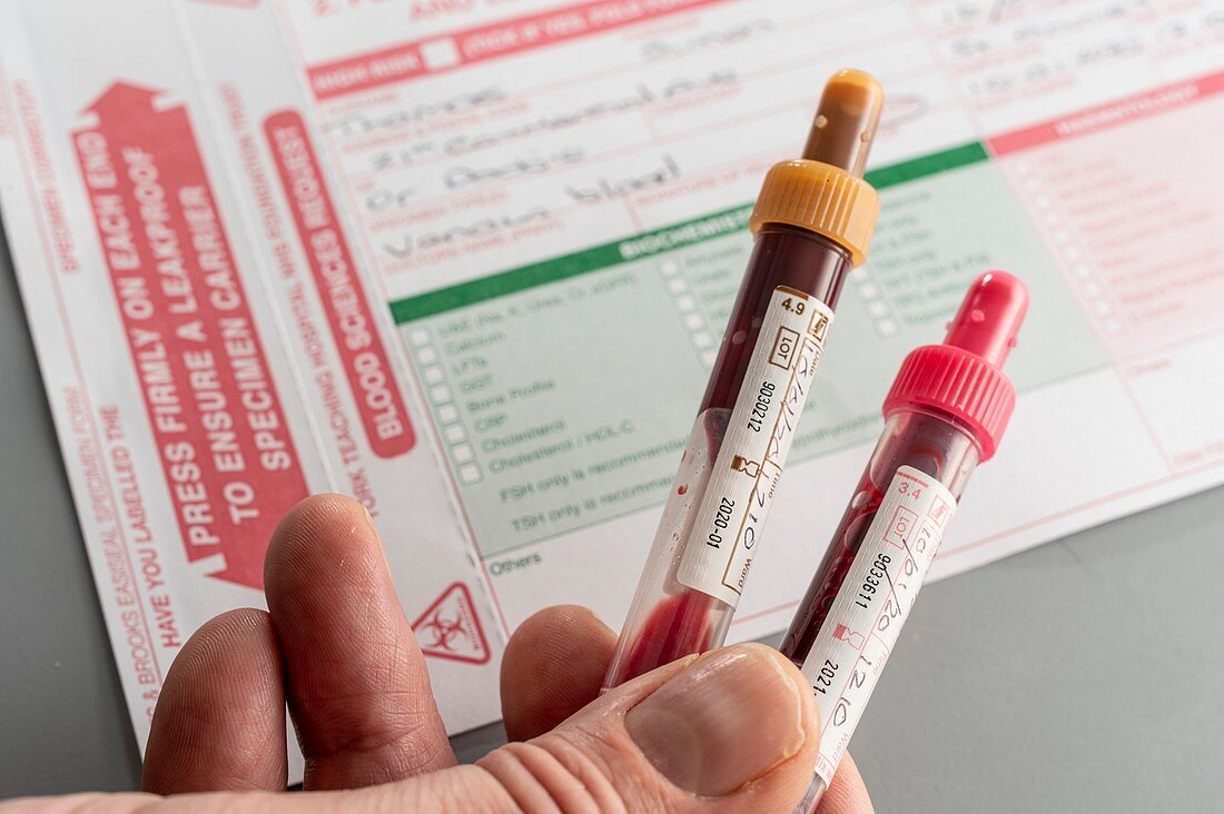 Blood test samples for analysis