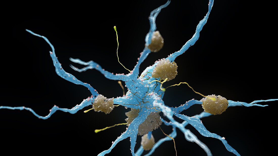 Alzheimer's nerve cells, illustration