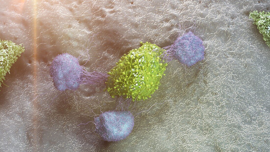 Cancer cell being attacked by leukocytes, illustration