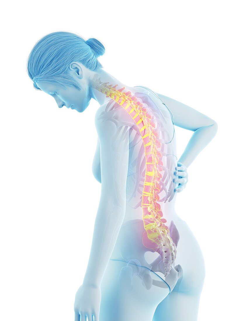 Woman with a painful back, illustration