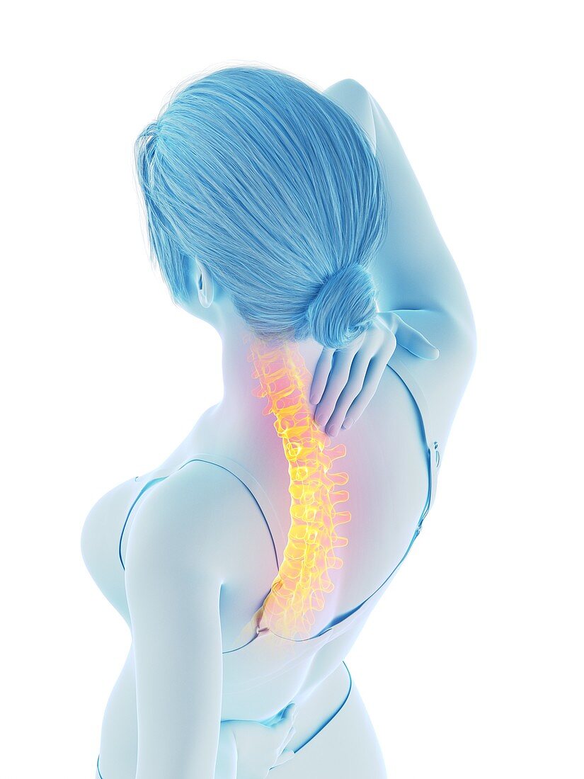 Woman with a painful back, illustration