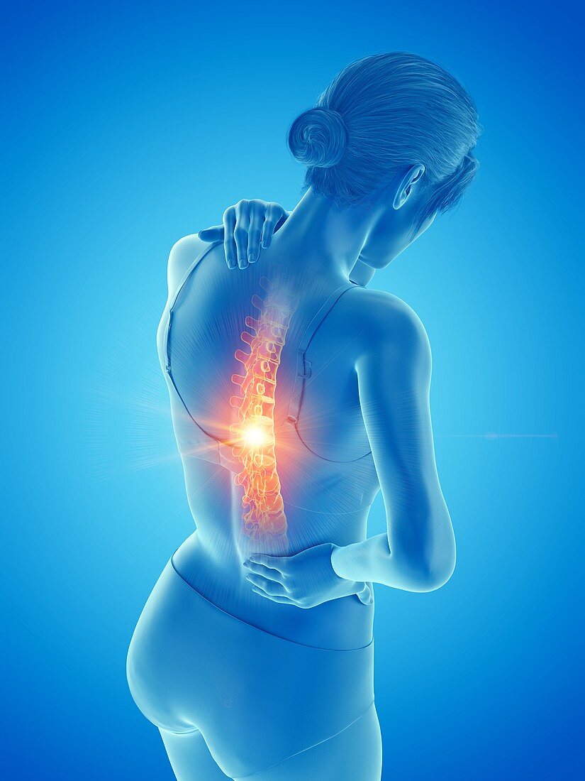 Woman with a painful back, illustration