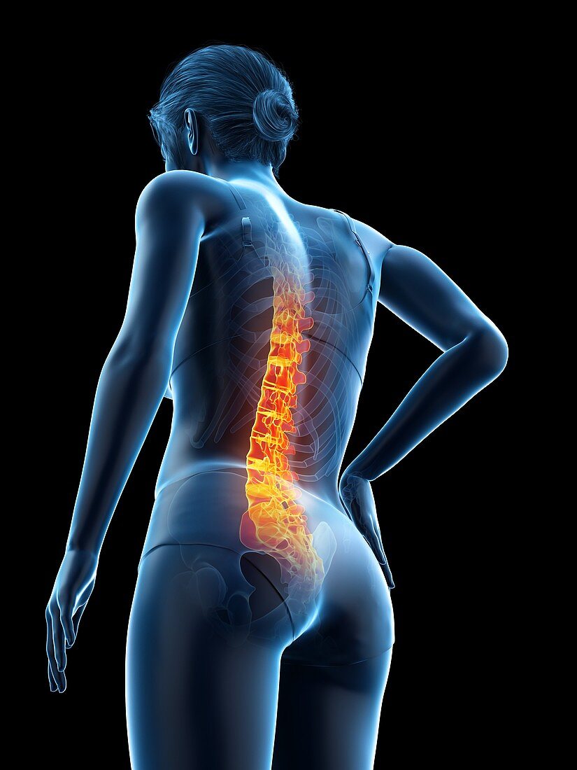 Woman with backache, illustration