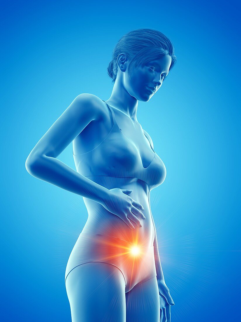 Woman with a painful abdomen, illustration