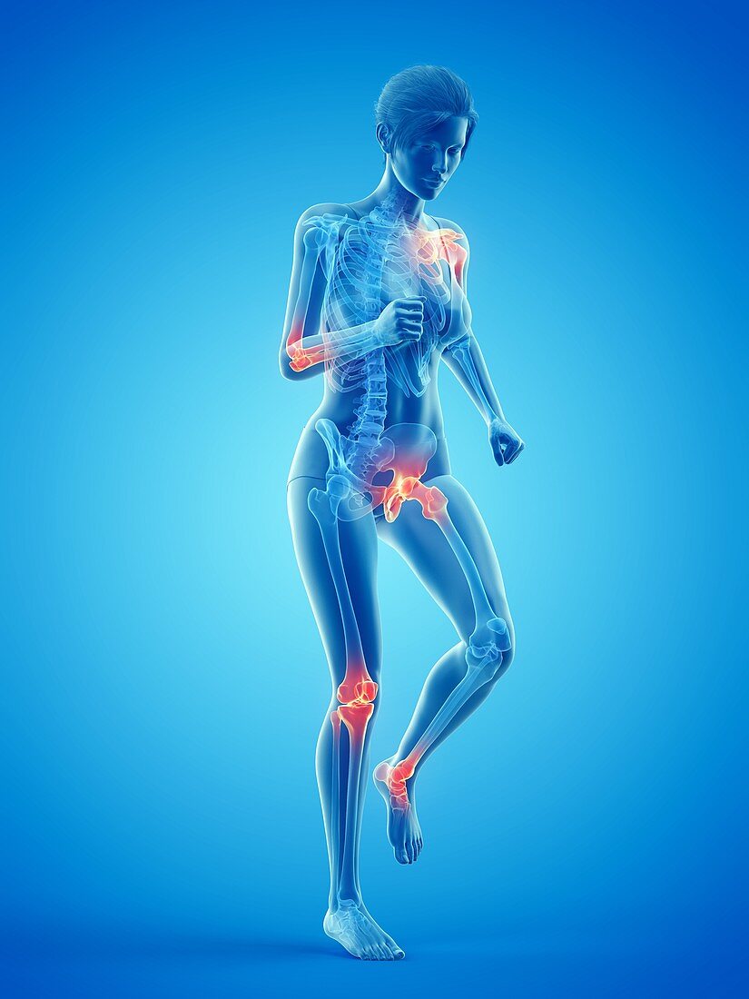 Woman with painful joints while walking, illustration