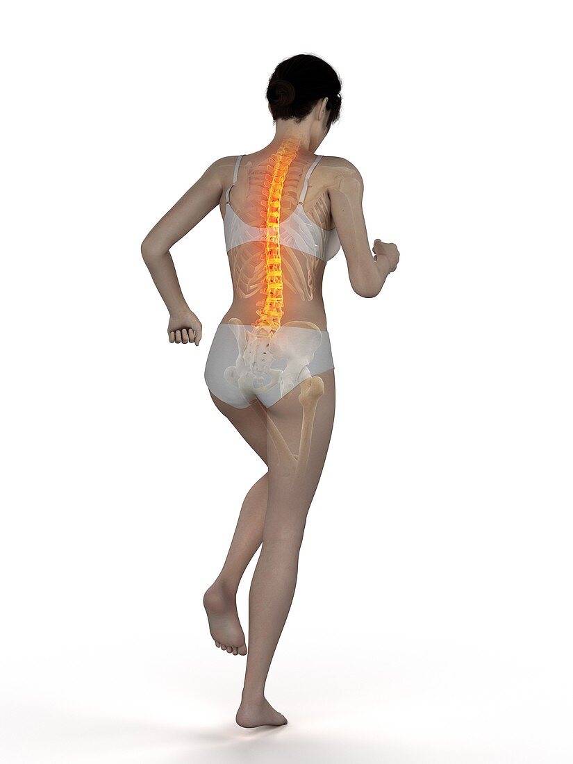 Woman with a painful back while walking, illustration