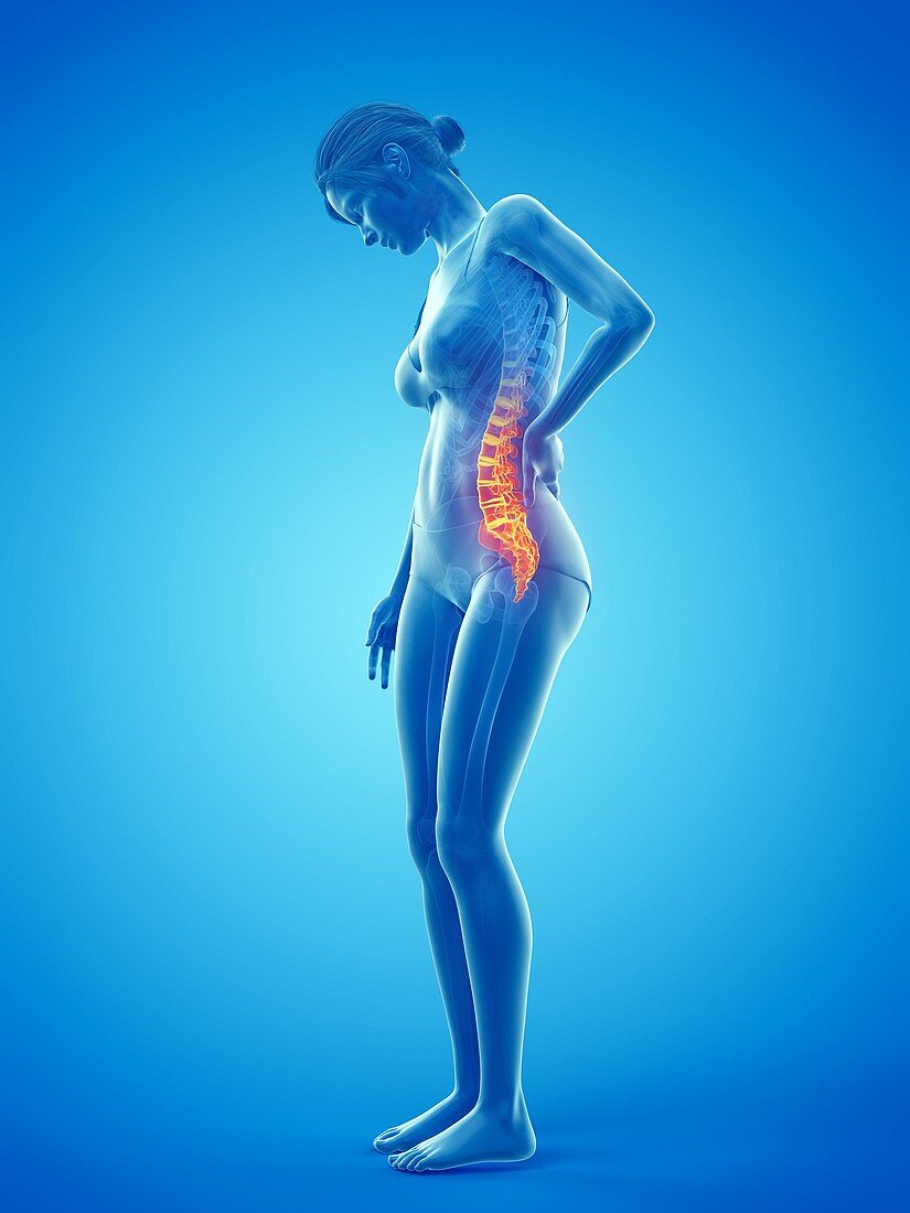 Woman with a painful back, illustration