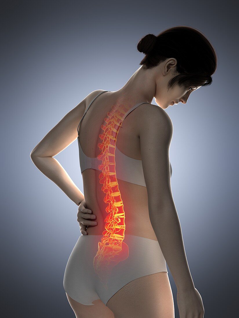 Woman with a painful back, illustration