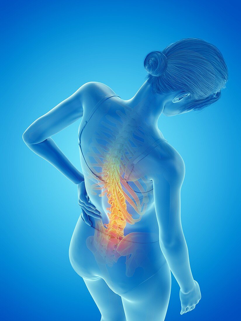 Woman with a painful back, illustration