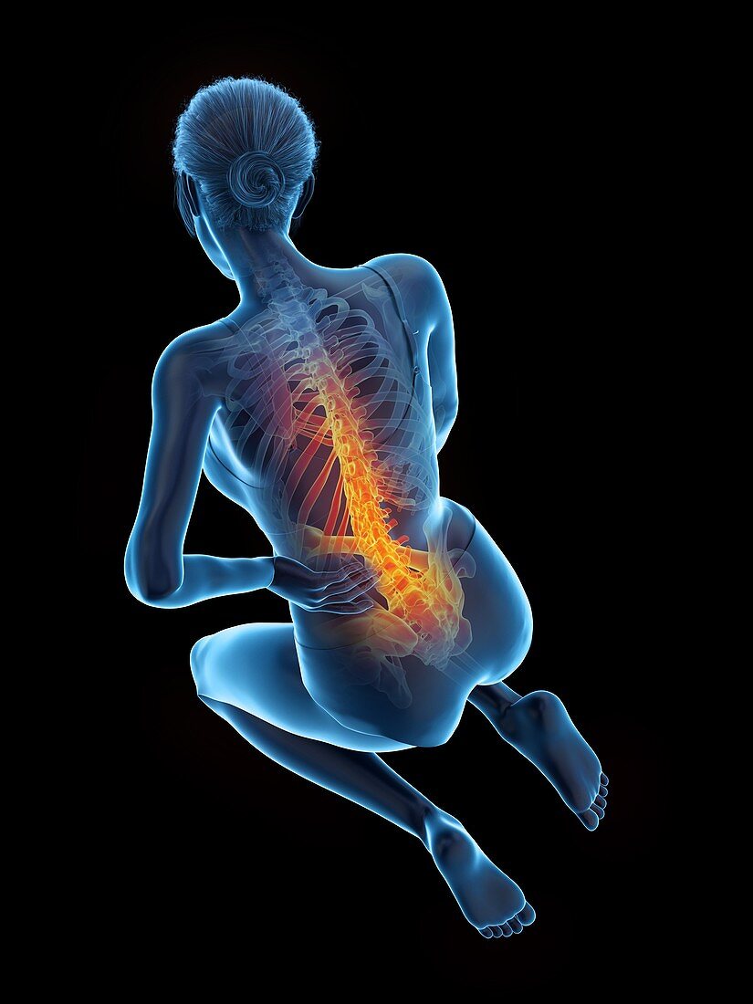 Woman with a painful back, illustration