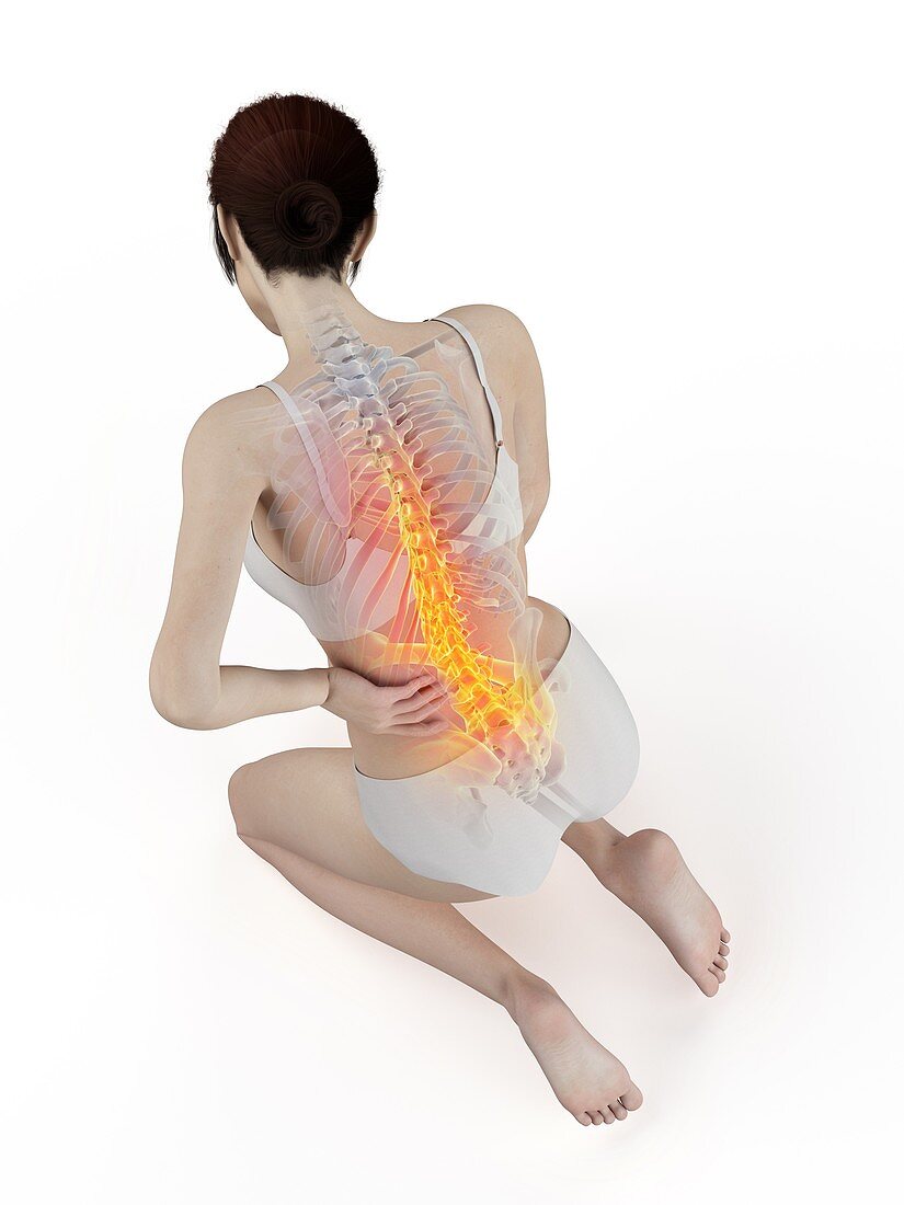 Woman with a painful back, illustration