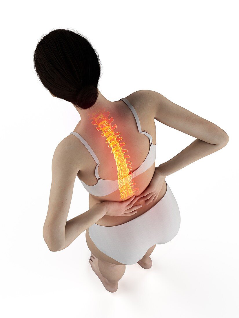 Woman with a painful back, illustration
