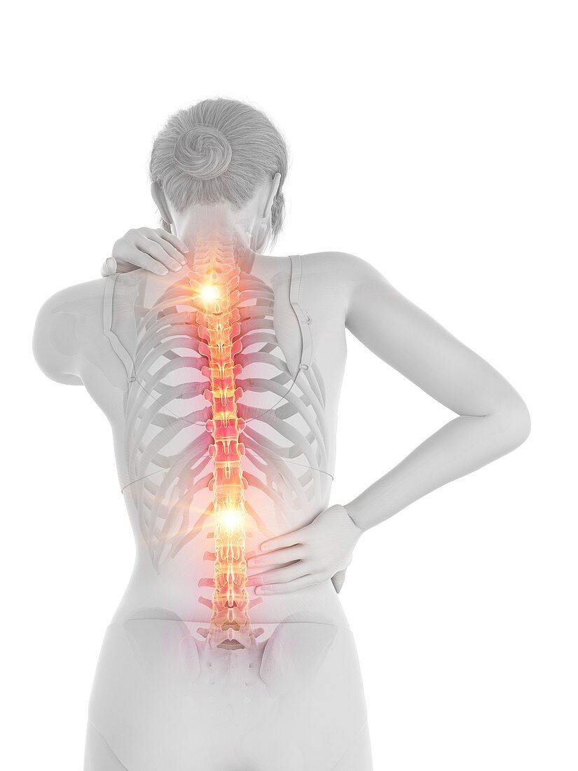 Woman with a painful back, illustration