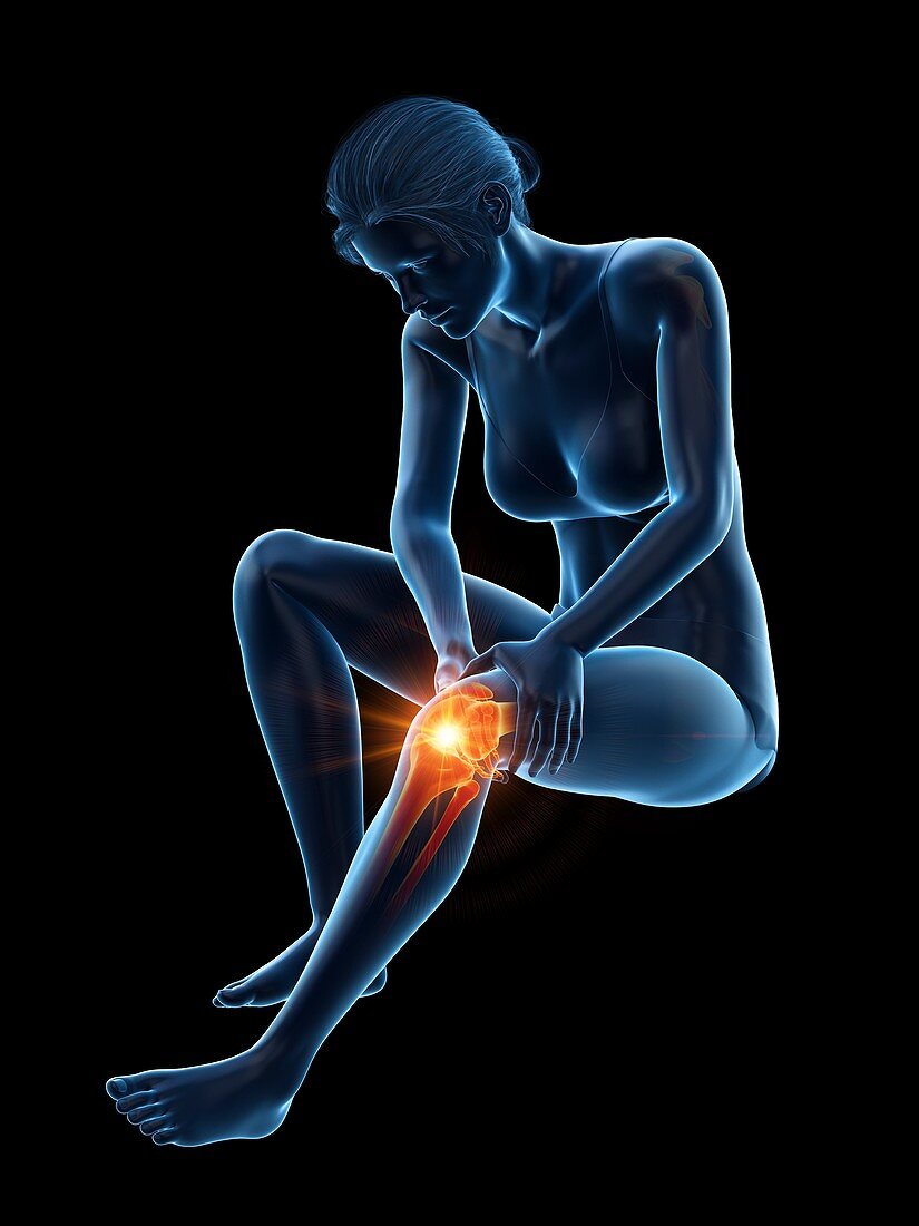 Woman with a painful knee, illustration