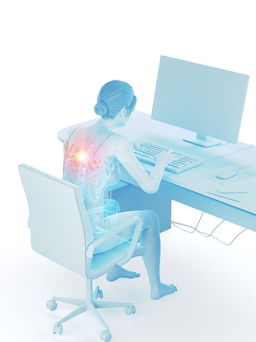 Woman with a painful back while working, illustration