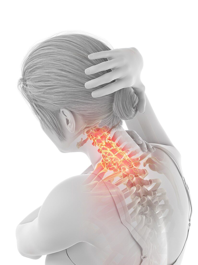 Woman with a painful neck, illustration