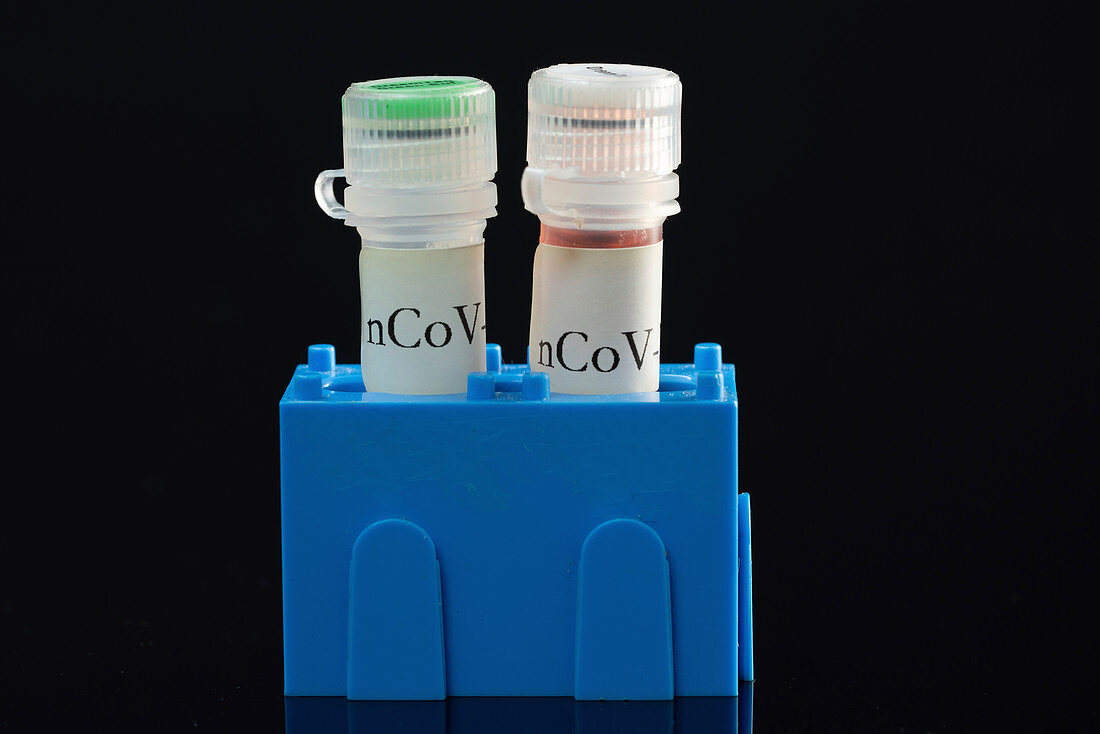 PCR test for covid-19 infection, conceptual image