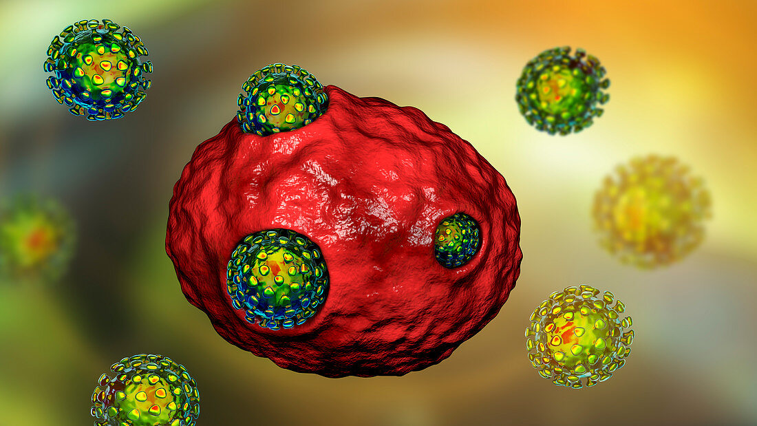 Covid-19 coronaviruses infecting human cells, illustration