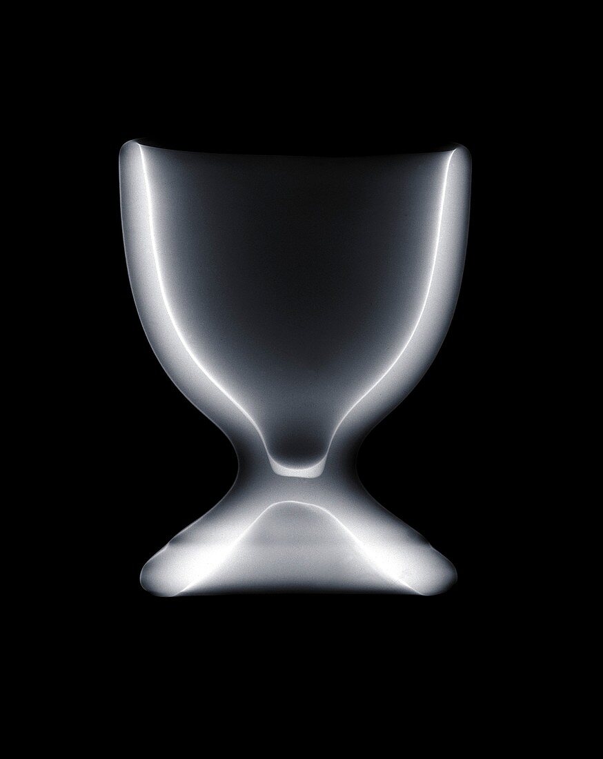 Egg cup, X-ray