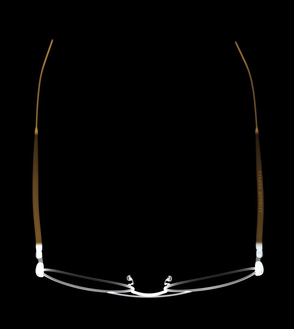 Spectacles from above, X-ray