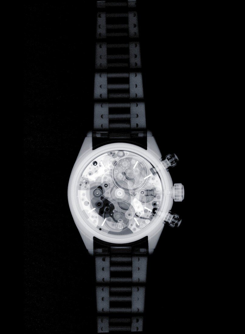Wrist watch, X-ray