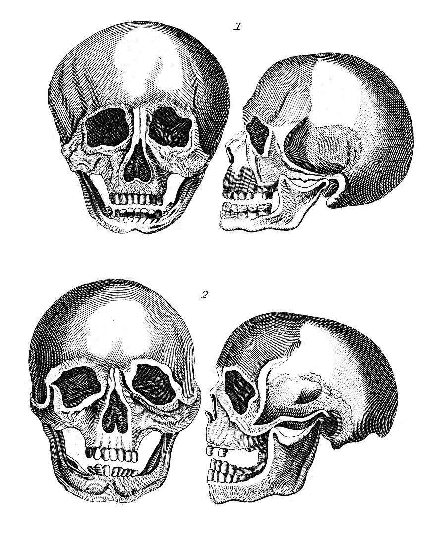 Comparison of Germanic and African skulls