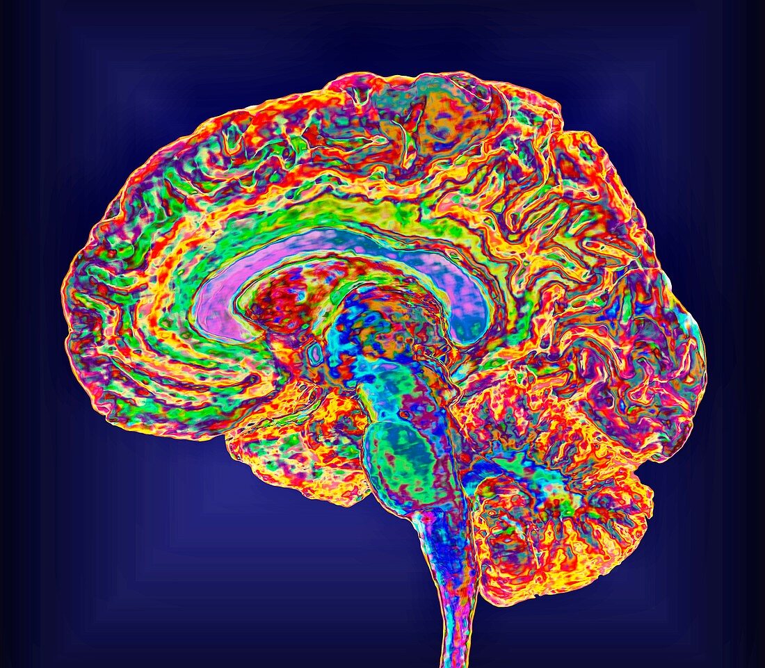 Human brain, sagittal MRI scan